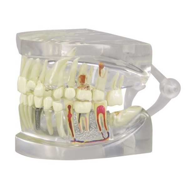 Gpi Anatomical Anatomical Model - Clear Teeth 2861